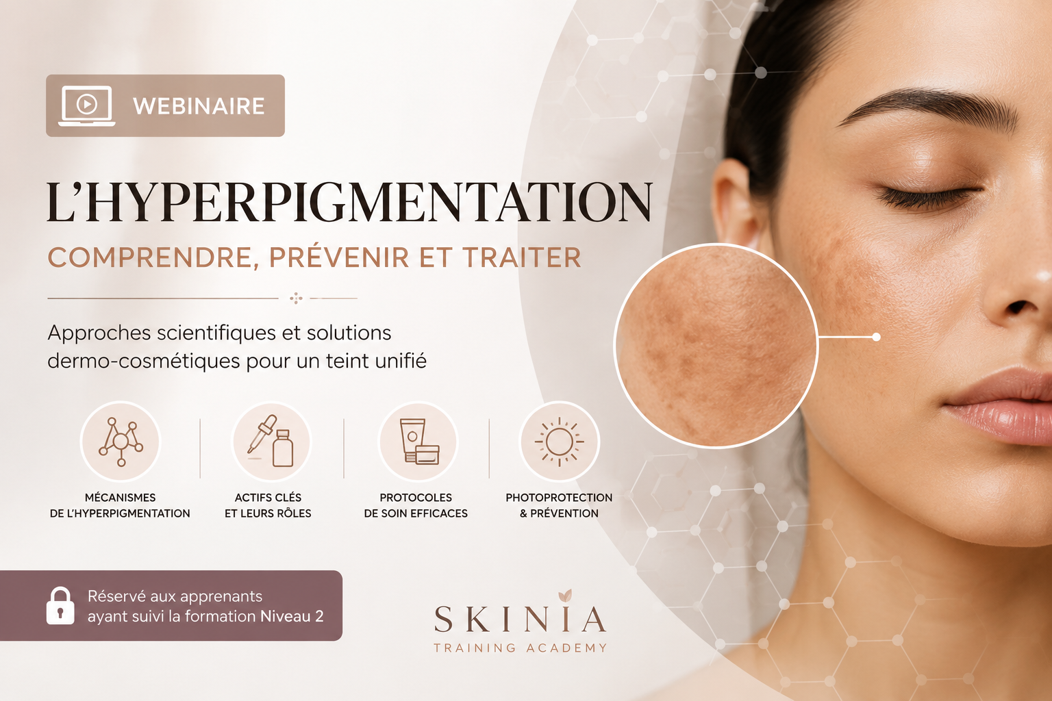 Webinaire sur l'hyperpigmentation